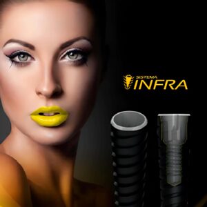 Implante Infra